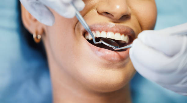 Best Dentist for Tooth Abscess  in Springfield, GA